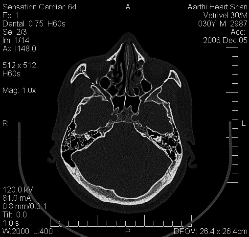 Automated Dicom Slice Analyzer